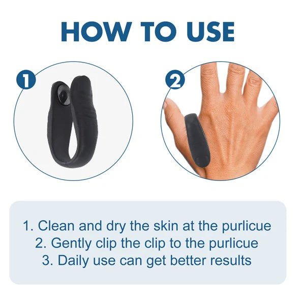 Sugar Control LI4 Acupressure Point Clip (Buy 1 Get 1 Free)